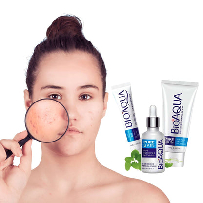 Kit Anti acne Bioaqua + mascarilla